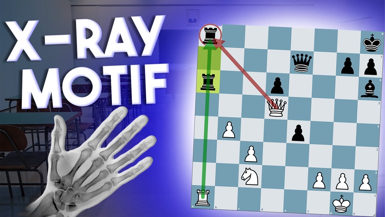 The X-ray Motif in Chess