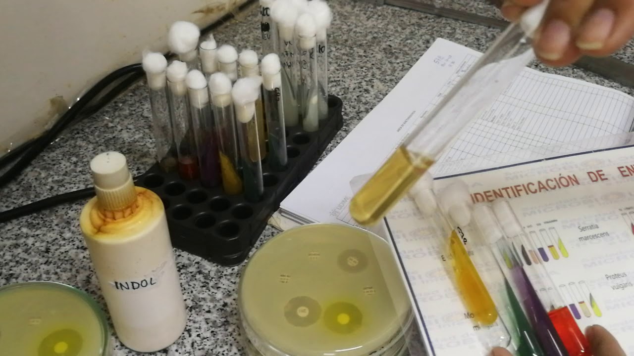 UROCULTIVO DÍA 3