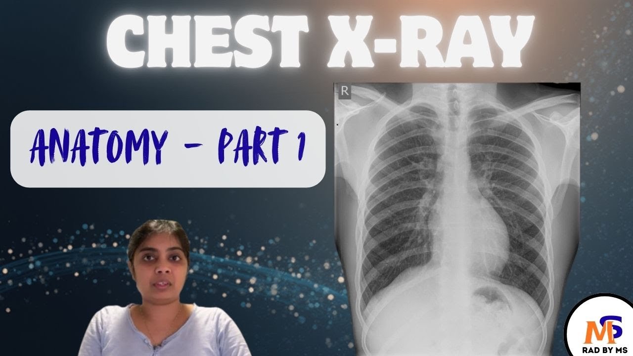 Chest X-Ray Anatomy (Part 1)