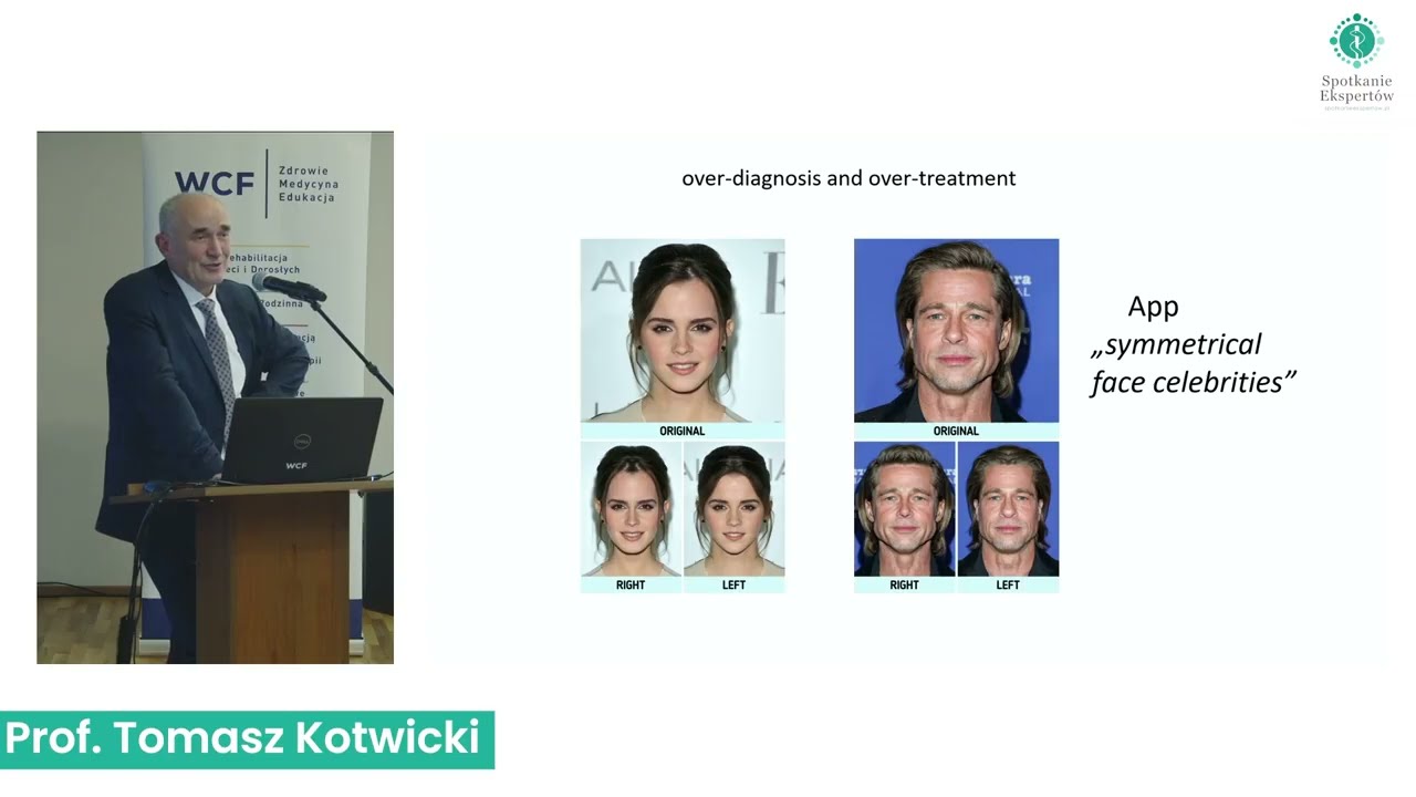 Prof. Tomasz Kotwicki - Skolioza strukturalna a skolioza funkcjonalna: pułapki w diagnozie i terapii