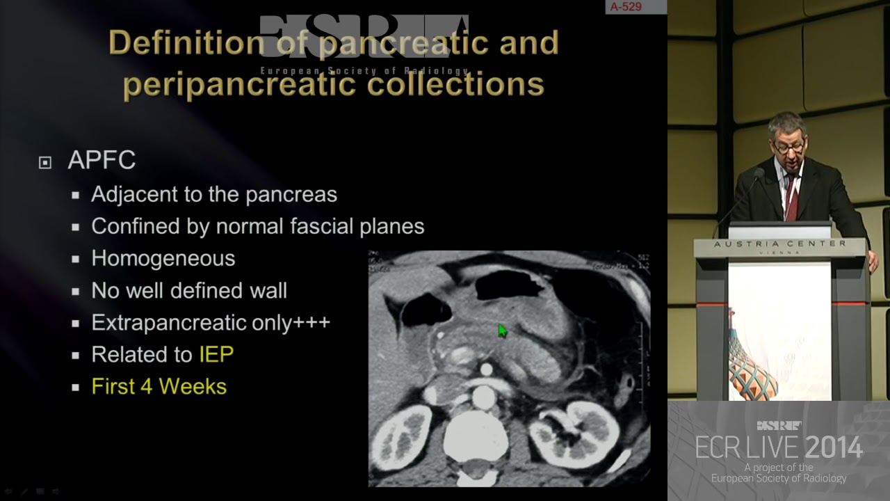 Imaging of acute Pancreatitis - HD [Basic Radiology]
