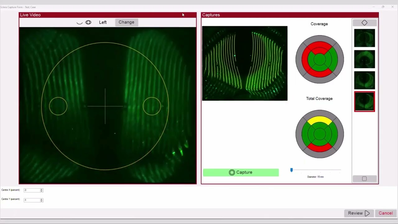 NIDEK | How to Take a Composite Capture Using the Meridia™ Vantage Corneal + Scleral Topographer