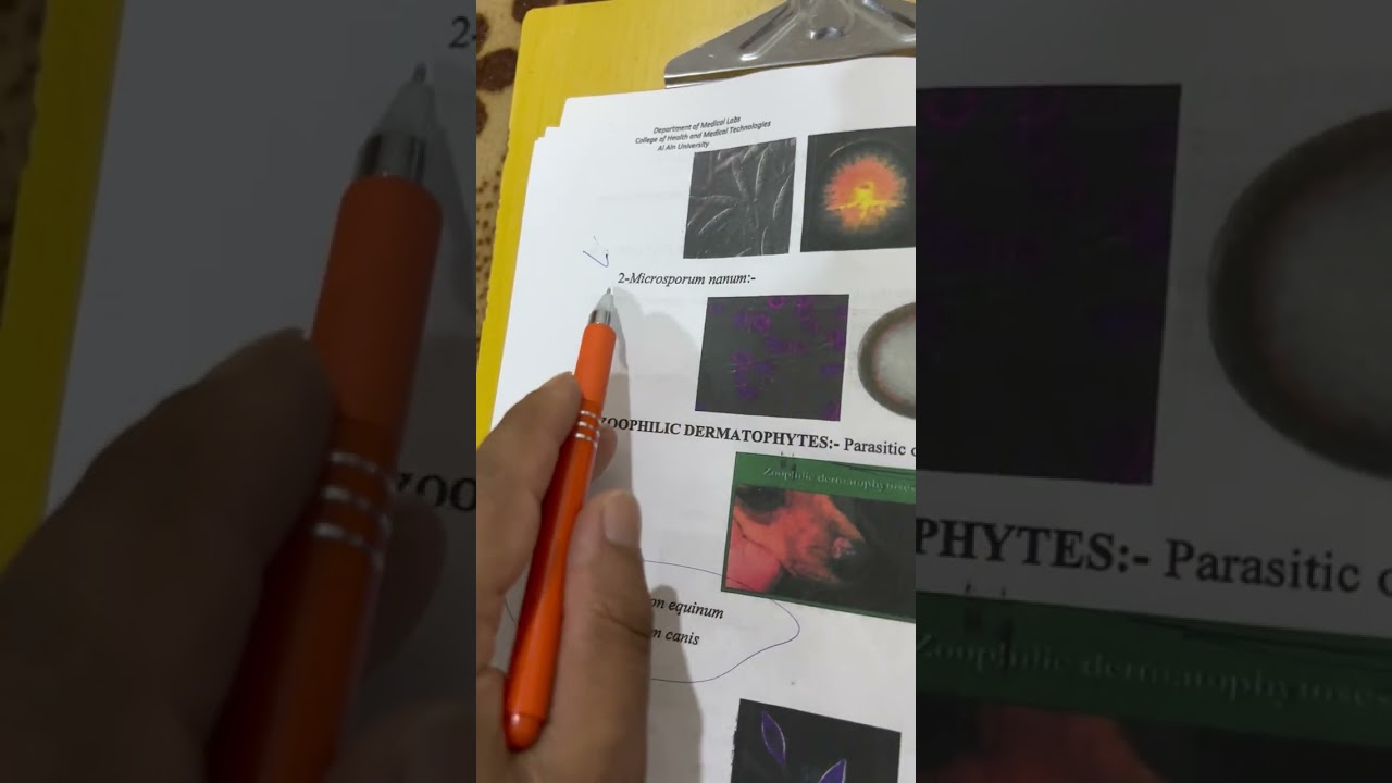 شرح محاضرة الفطريات النظري ال ثالثة الفديو الاول وزاري