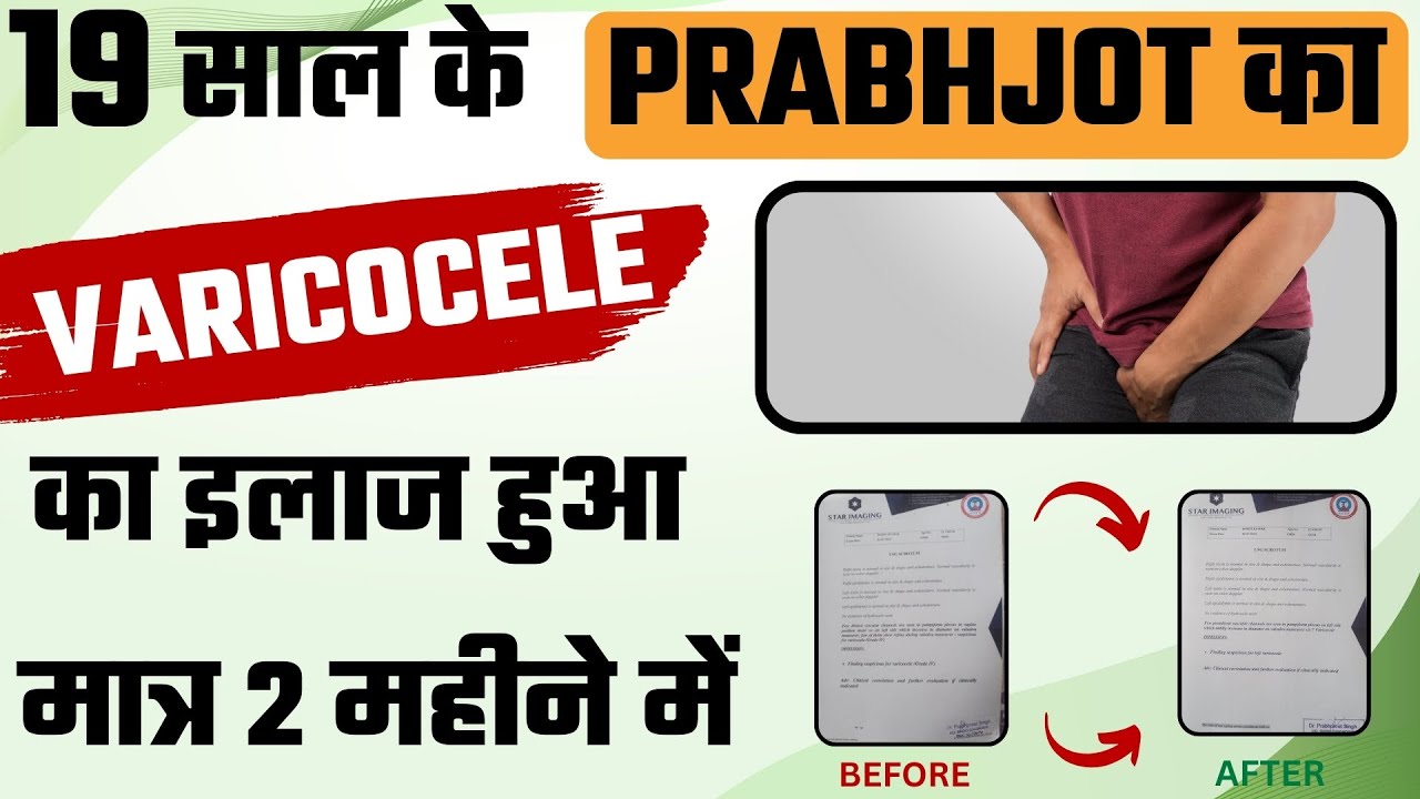 19 साल के Prabhjot का Varicocele का इलाज हुआ मात्र 2 महीने में | Bharat Homeopathy Varicocele Review