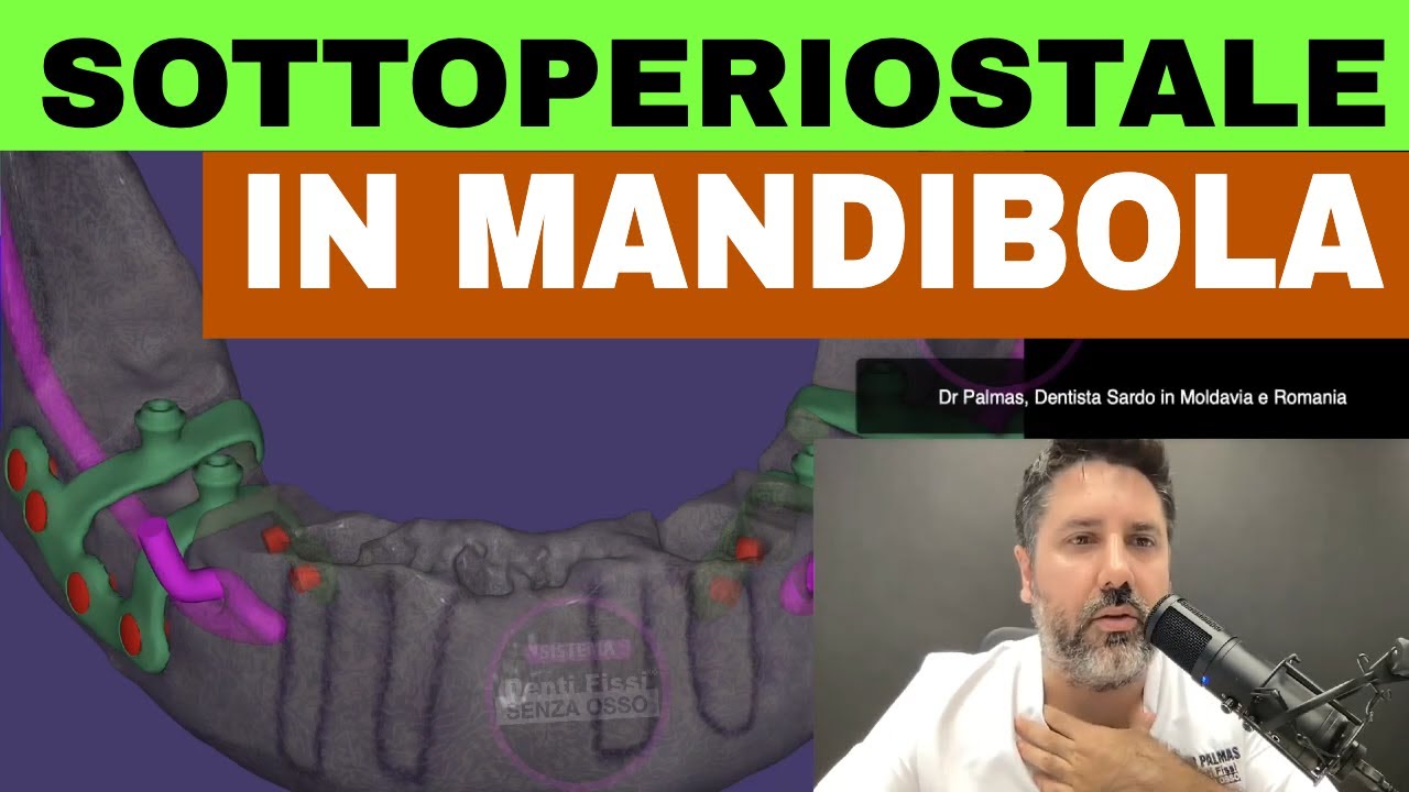 Griglie sottoperiostali mandibola inferiore
