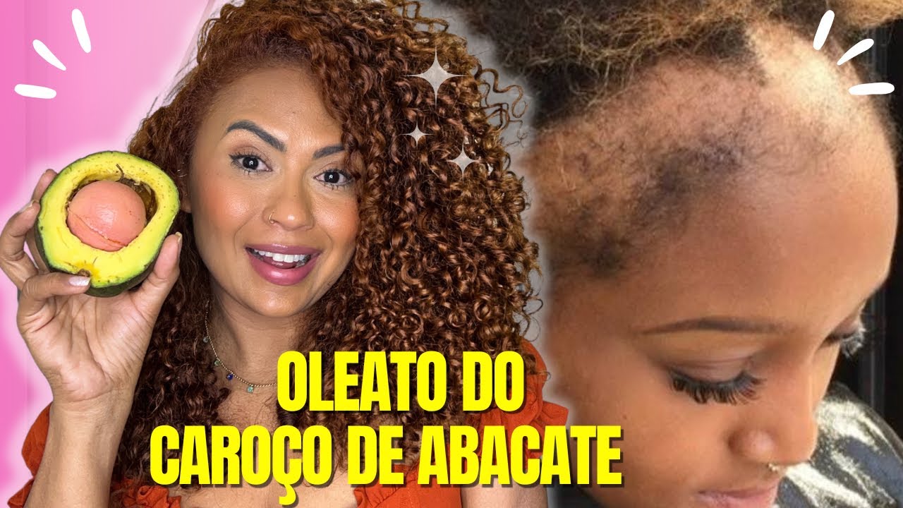 ESQUEÇA OS CABELOS GRISALHOS E CARECAS! APENAS INGREDIENTES FORTES E SEU CABELO CRESCERÁ RÁPIDO