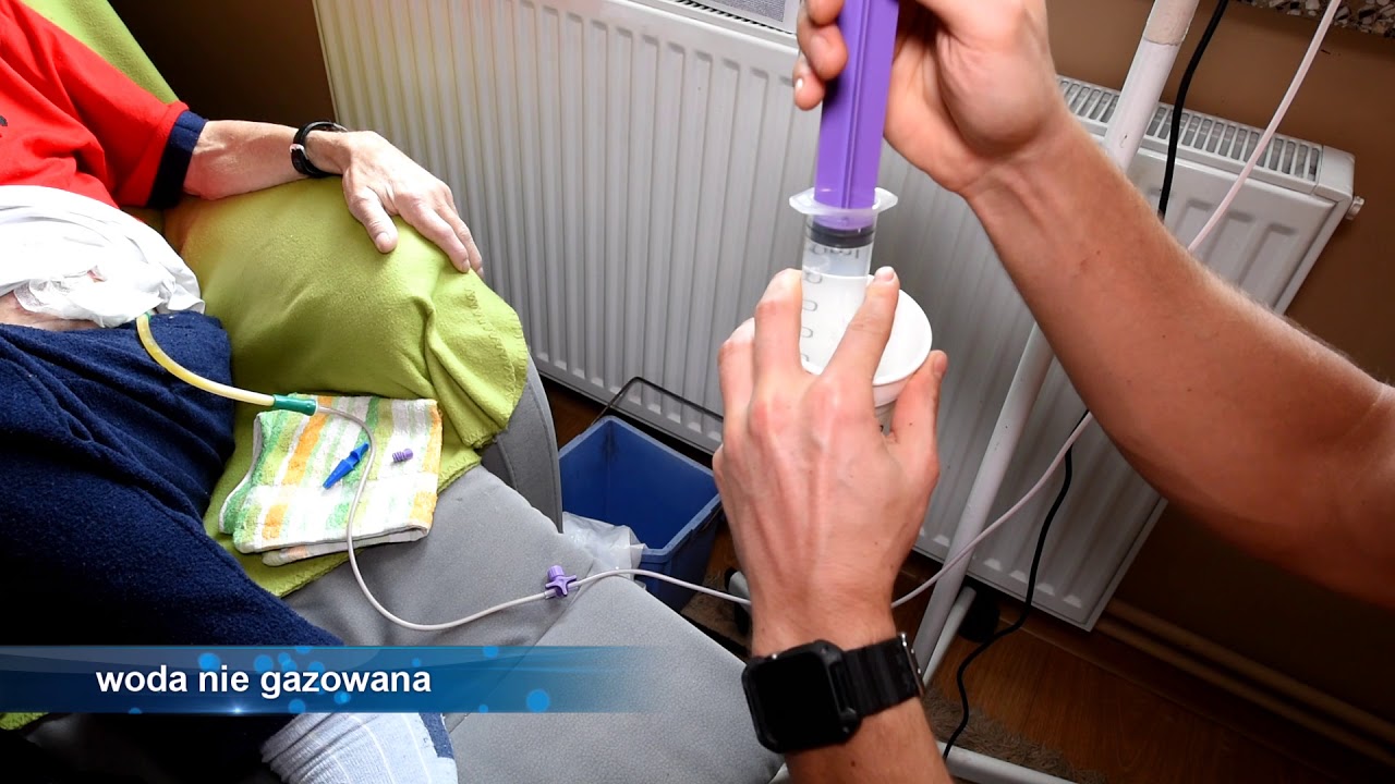 Żywienie dojelitowe Nutricia film instruktażowy