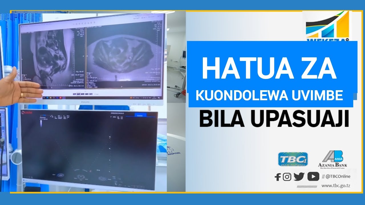 HIZI NDIZO HATUA ANAZOFANYIWA MGONJWA HADI KUTOLEWA UVIMBE MWILINI BILA KUFANYIWA UPASUAJI.