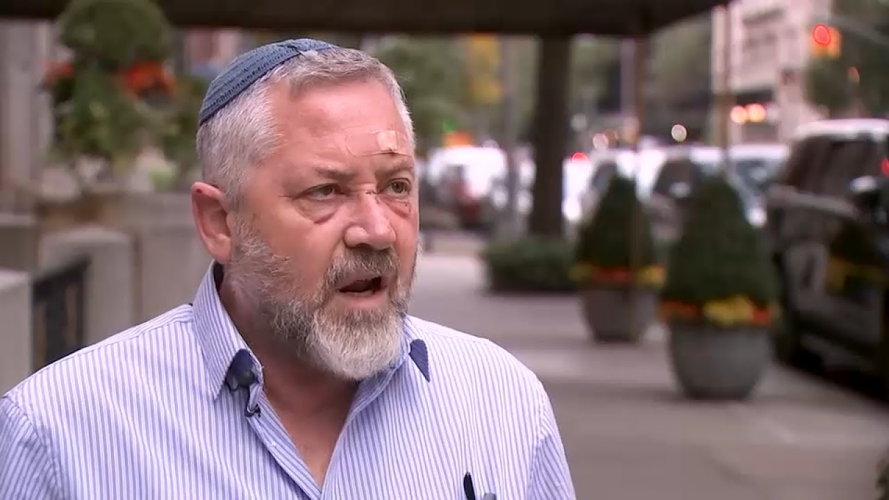 Tourist from Israel sucker punched during unprovoked attack in Midtown