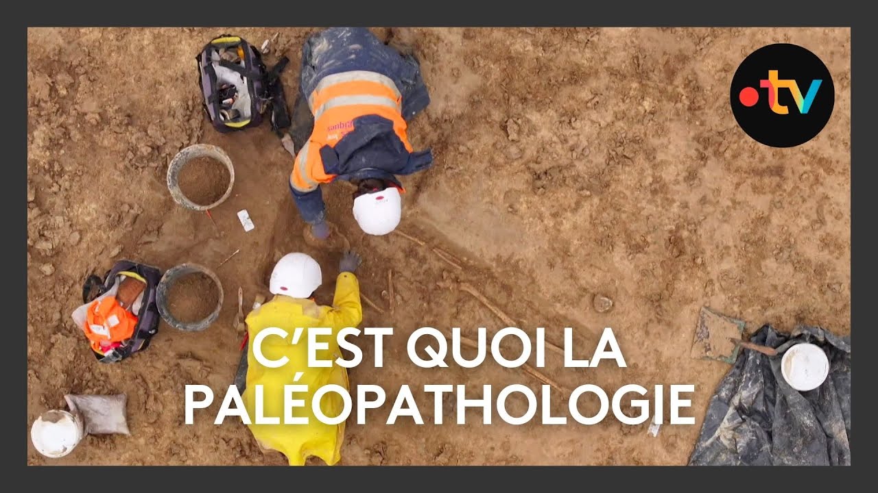Découvrez Aminte Thomann, Archéologue Spécialiste en Paléopathologie en Normandie