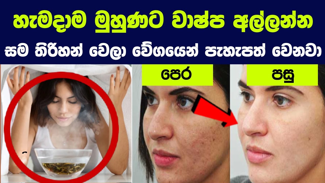 හැමදාම මුහුණට වාෂ්ප ඇල්ලුවොත් , මුහුණට සිදුවන පුදුමසගත දේවල් 09ක්