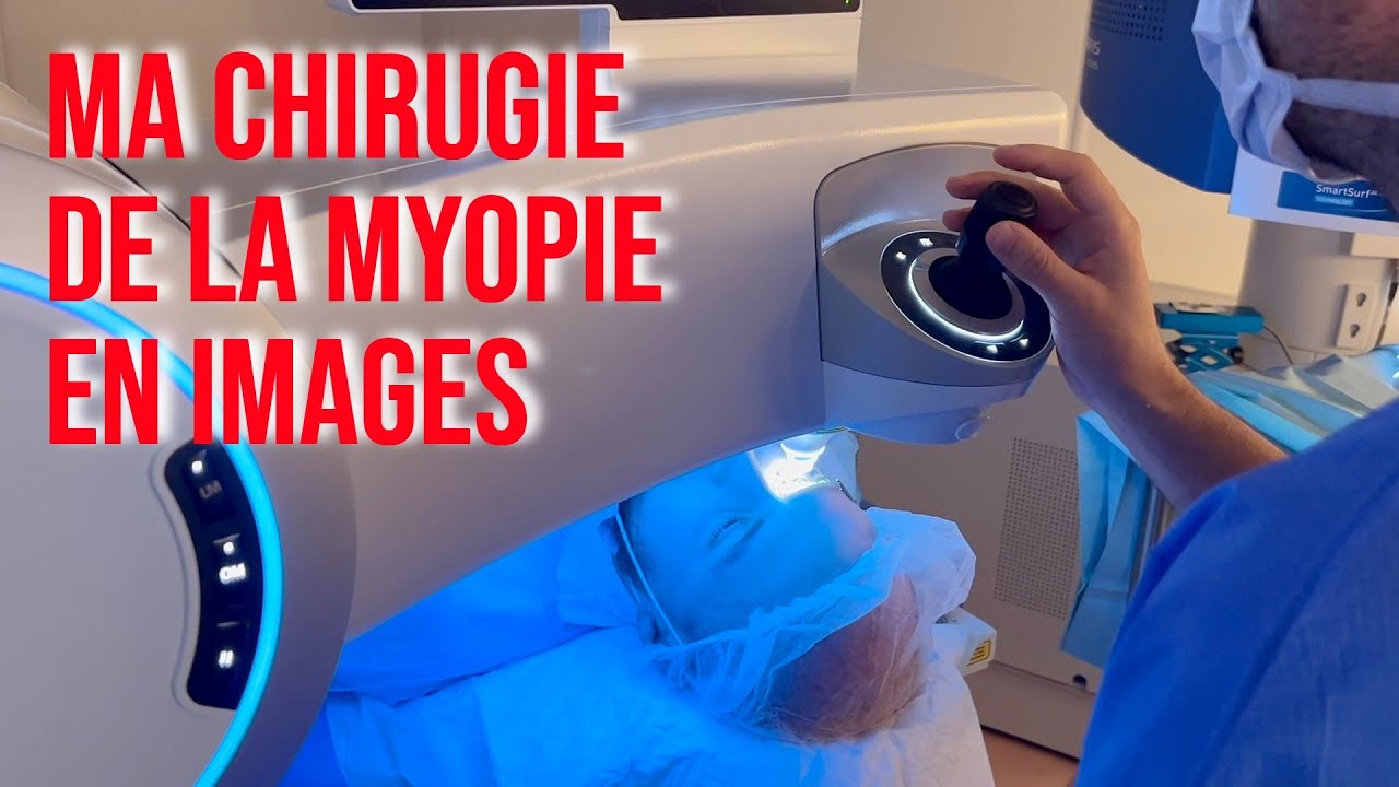 Mon opération de la myopie ! Les images  de ma Chirurgie Lasik par le Dr Antony AMARAL
