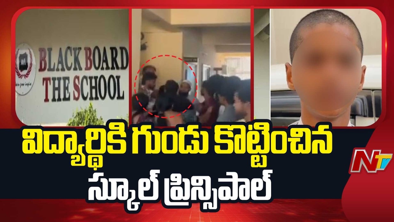 Miyapur : జుట్టు ఎక్కువగా ఉందని విద్యార్థికి గుండు కొట్టించిన స్కూల్ ప్రిన్సిపాల్ | NTV Telugu