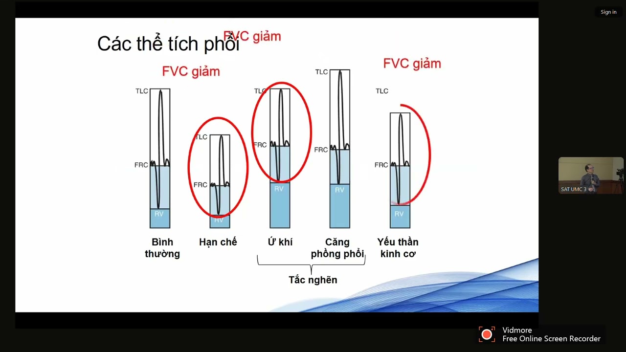 Pre-COPD hay PRISm: Khái niệm lý thuyết hay ứng dụng lâm sàng? THS. BS. VŨ TRẦN THIÊN QUÂN