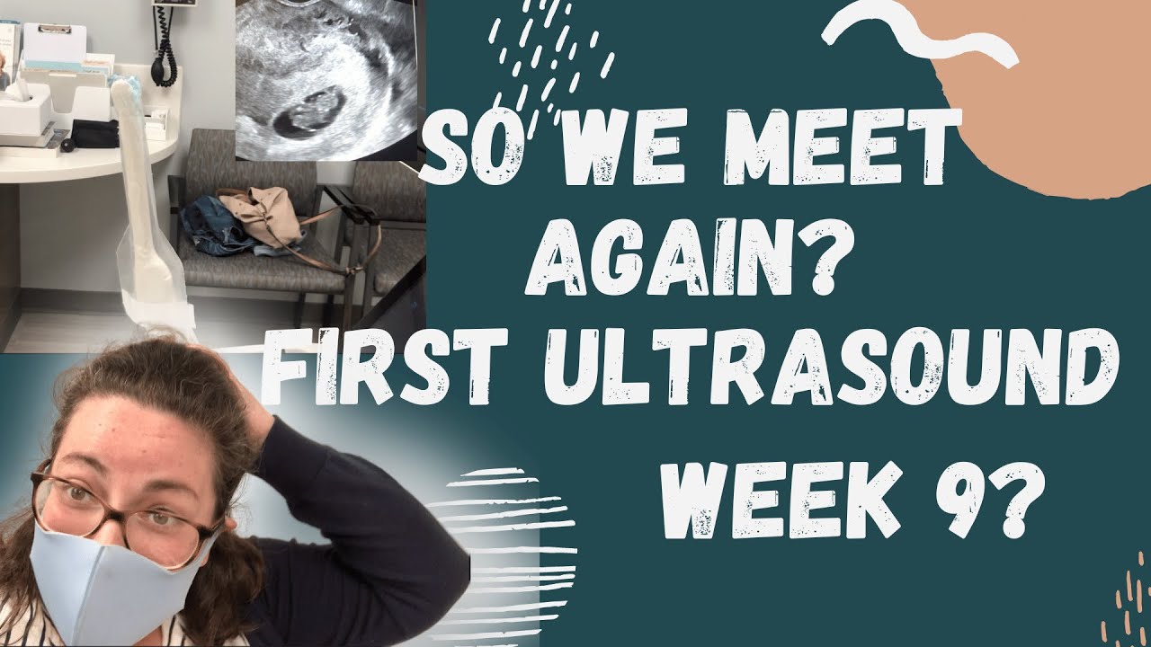 Plus Size Pregnancy   First ultrasound + ob appointment   week 9 update