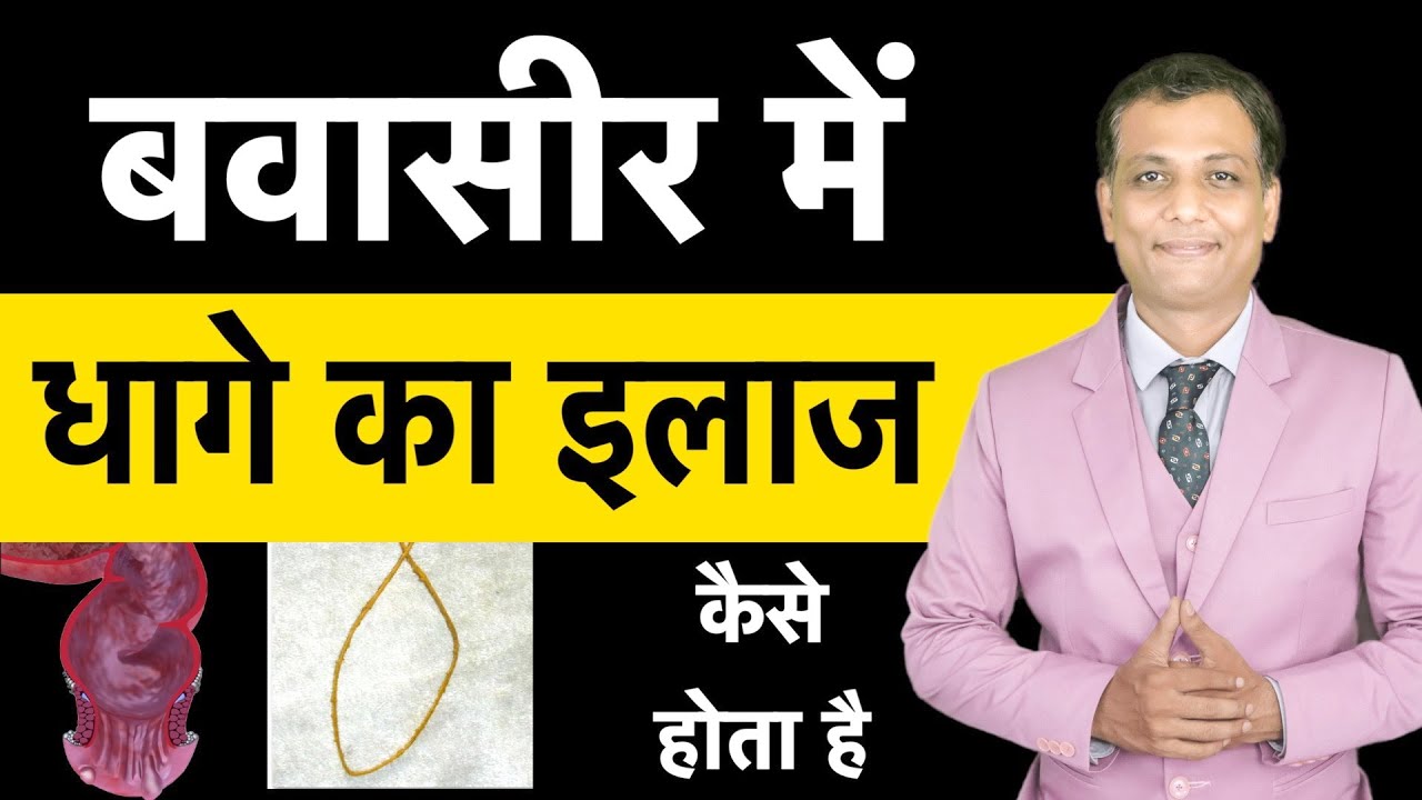 बवासीर में धागे का इलाज कैसे होता है | Piles Treatment Ayurveda Ksharsutra | Dr Dipak Piles Laser