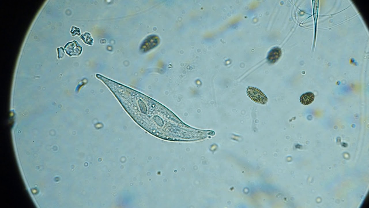 Rotifera, coleps, nematode