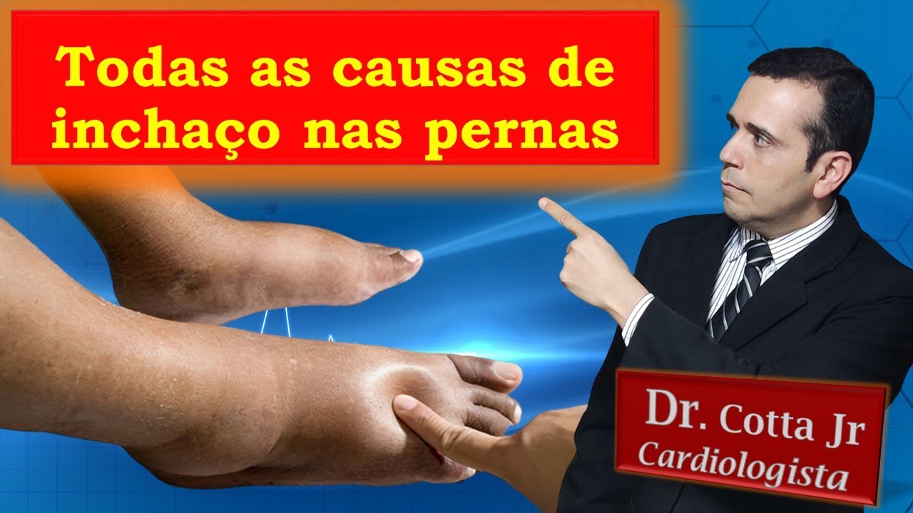 O que pode ser Inchaço nos Pés e nas Pernas? Vídeo definitivo sobre todas as causas e como resolver