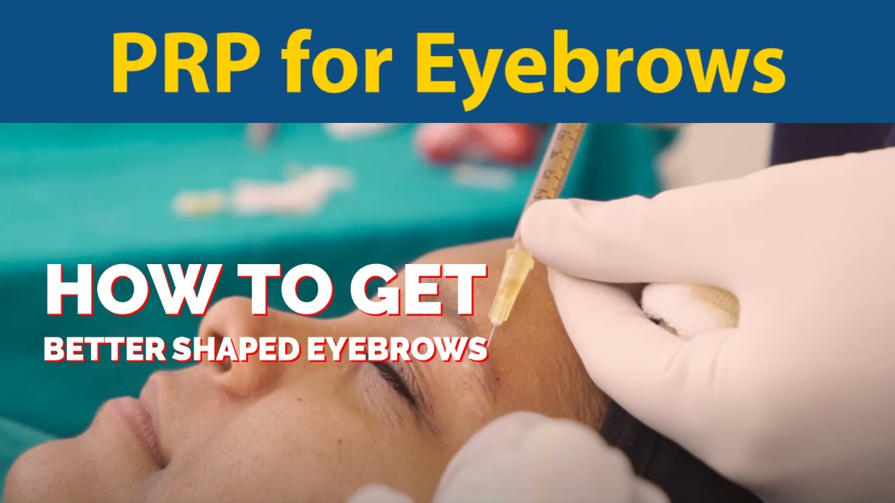 PRP for eyebrows | How To get better shaped eyebrows | Dr. Jyoti Gupta Clinic