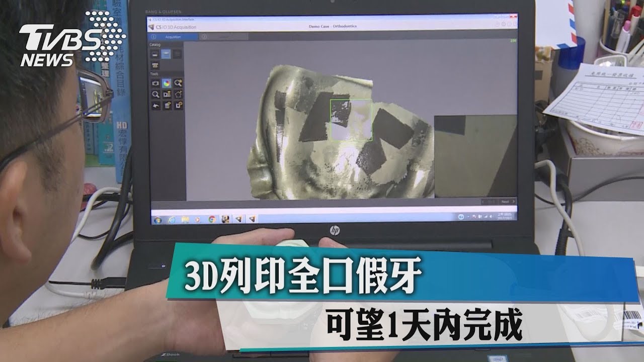 3D列印全口假牙　可望1天內完成