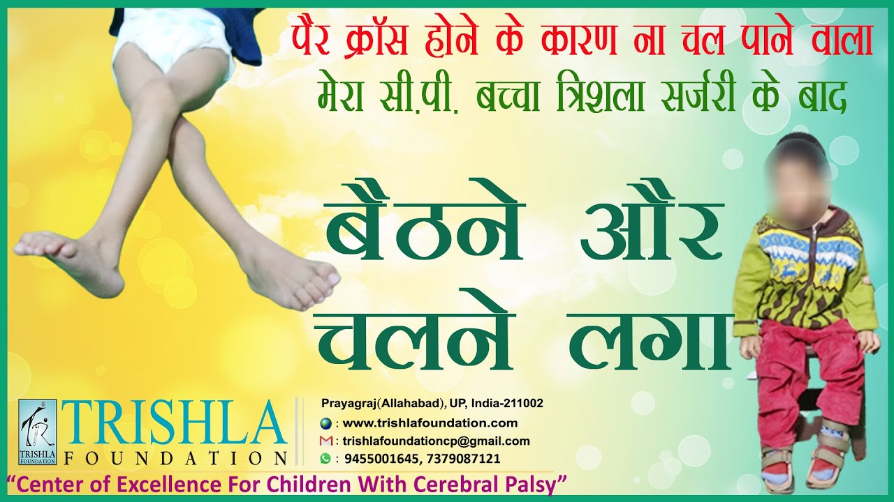 CP Success Story: Cerebral Palsy with Bilateral Hip Dislocation Managed Successfully | Trishla