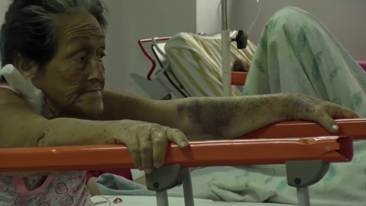 ¿Cómo es la vida de un paciente con VIH en Venezuela?