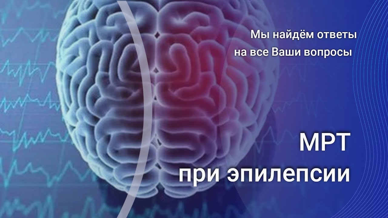 МРТ при эпилепсии