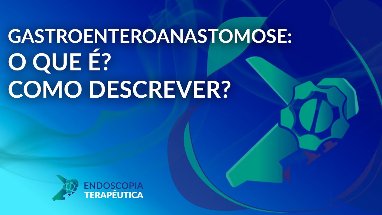 Gastroenteroanastomose o que é? Como descrever?