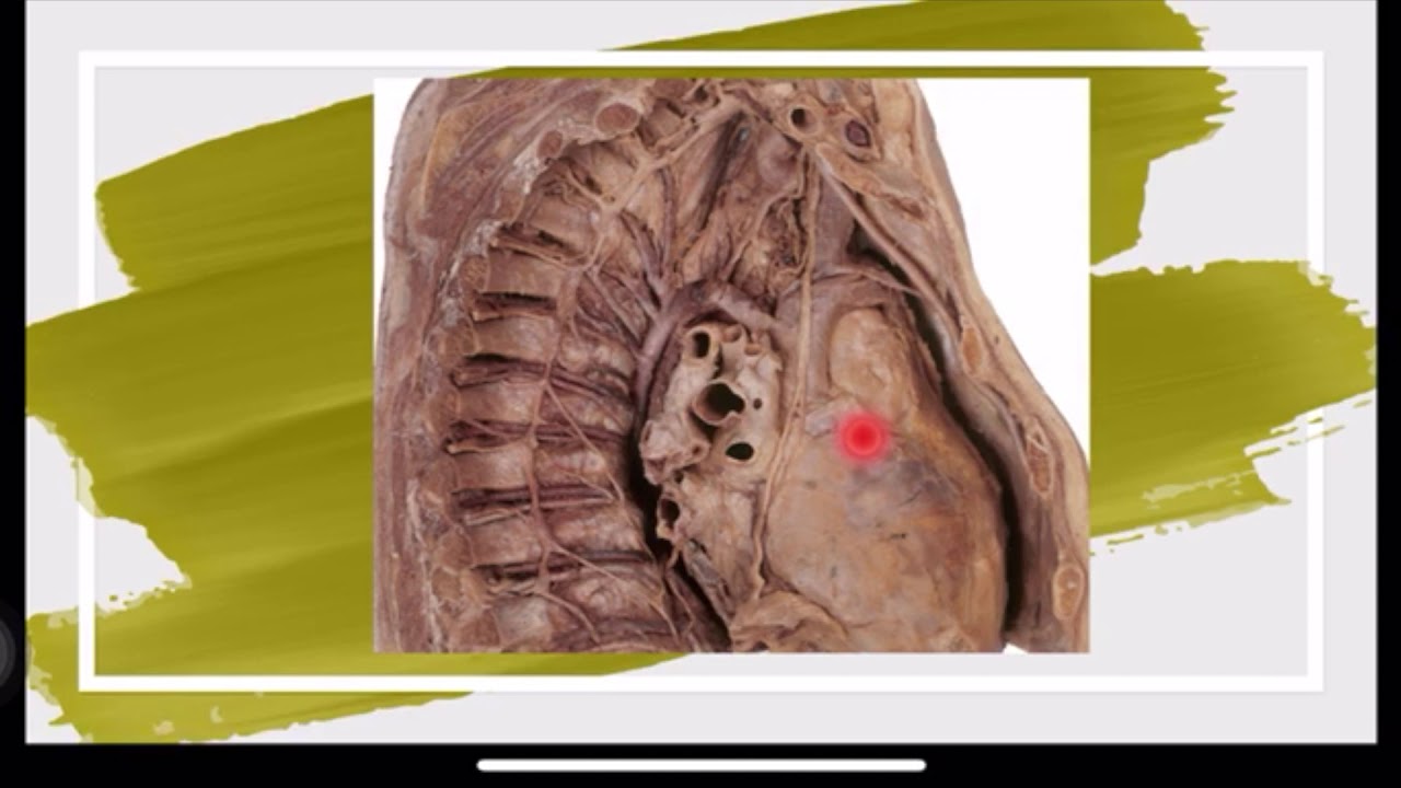 Plexo cervical.
