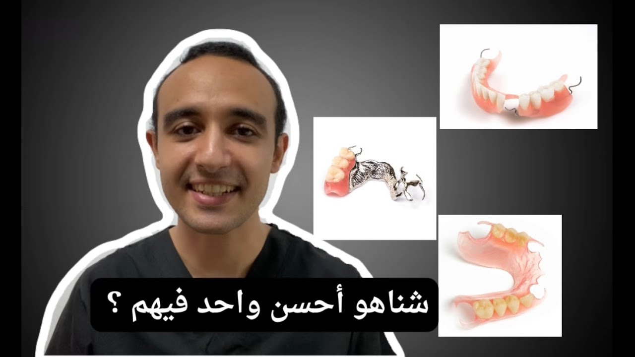 أنواع طقم الأسنان الجزئي