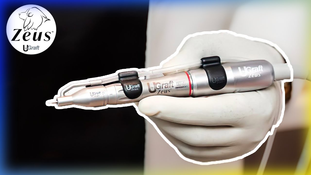UGraft™ FUE London - Westminster Medical Group®
