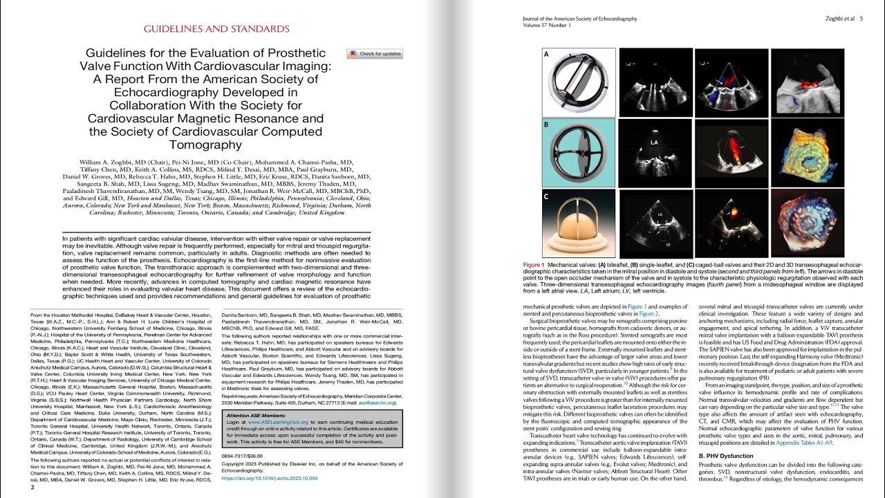 2024 ASE guidelines on Prosthetic Valve Assessment