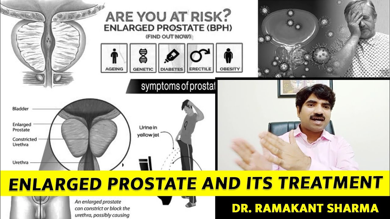 Prostate Gland: बढ़ी हुई प्रोस्टेट के लक्षण और उपचार | Dr Ramakant Sharma
