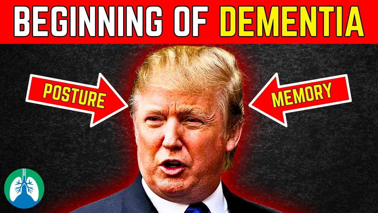 Top 10 Early Dementia Signs Most People Miss | Until It’s Too Late