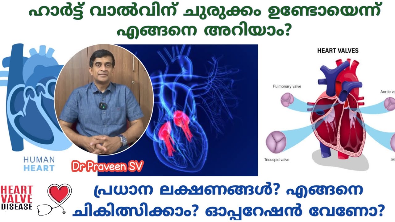 Heart valve disease malayalam|Aortic stenosis malayalam|Mitral stenosis