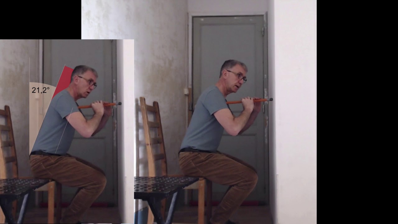 The FrogDance procedure