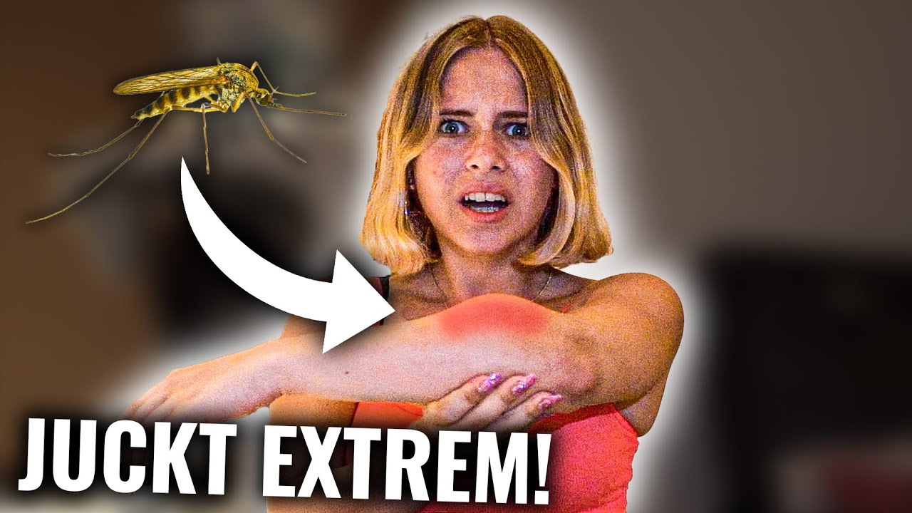 ICH habe einen EXTREM FETTEN MÜCKENSTICH! (tut sooooo wehhhh) II DAILY VLOG 456