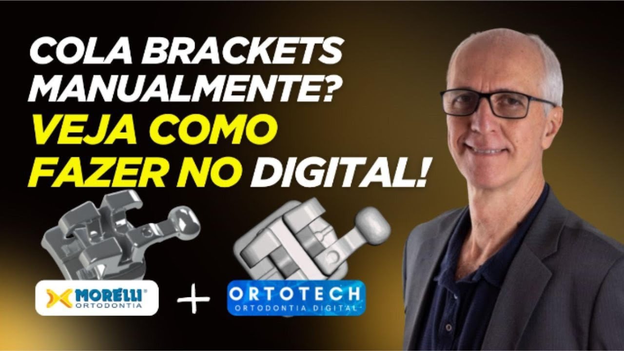 Como Usar os Braquetes Morelli na Colagem Indireta Digital