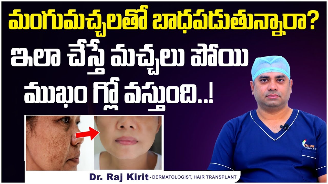 మంగుమచ్చలు పోవాలంటే | How to Get Rid of Melasma on Face? | Melasma Treatment | Celestee Skin Clinic