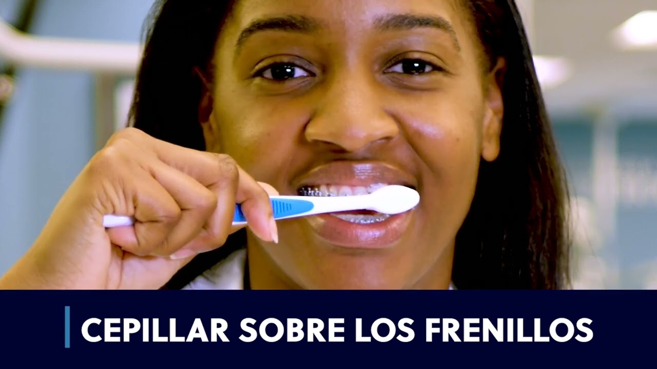 Cómo Cuidar tus Brackets | Consejos de Ortodoncia - Georgia School of Orthodontics