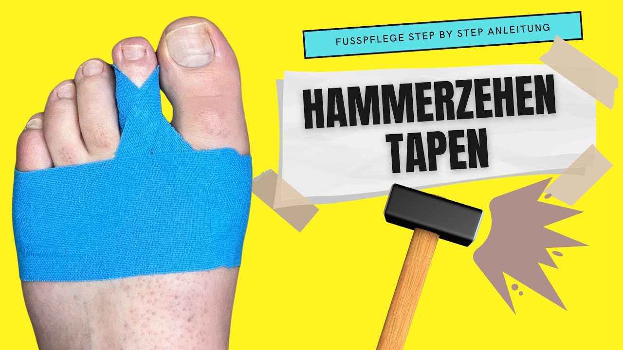 HAMMERZEH TAPEN | Hammerzehen tapen Anleitung