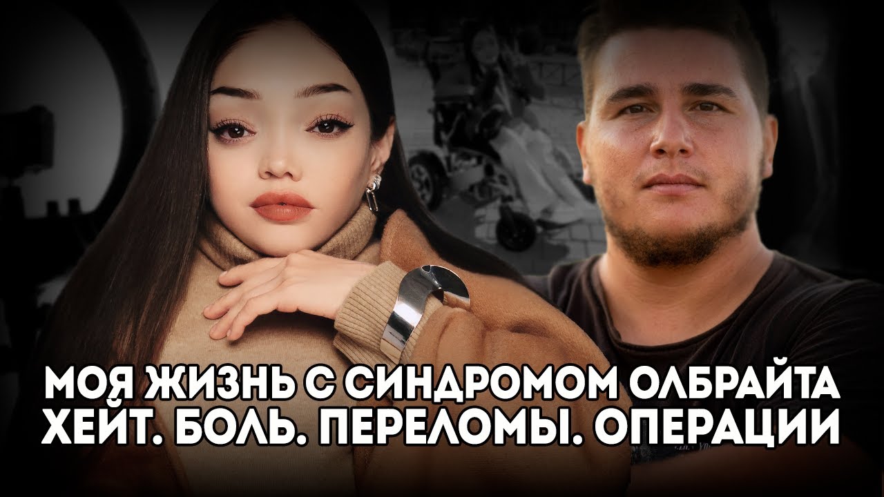 Как сильная девушка справляется с болью и хейтом - вдохновляющая история Лили с синдромом Олбрайта