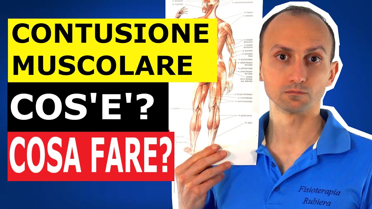 Contusione Muscolare: Cos'è e Cosa Fare