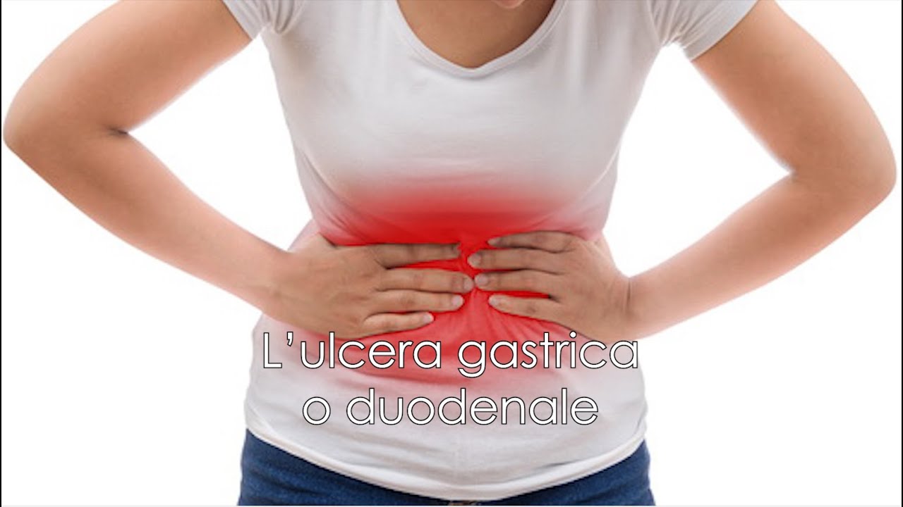 L'ulcera gastrica o duodenale