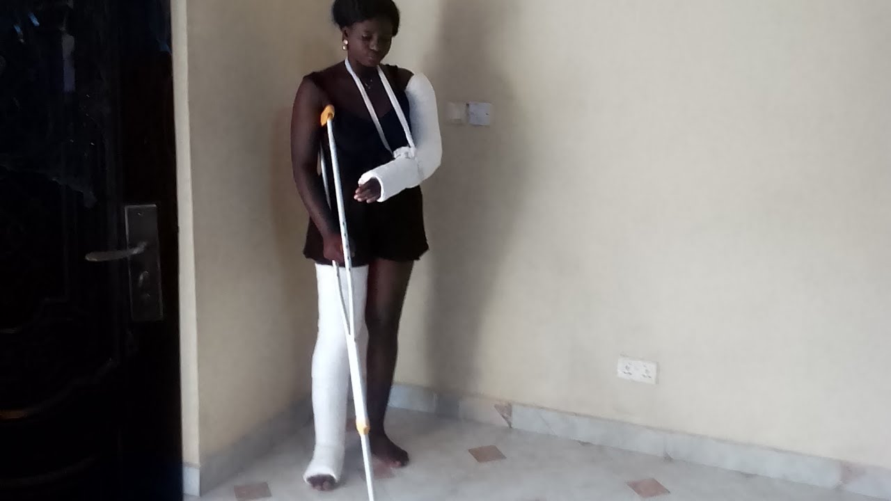 #fine Lady trying to walk after Accident  injury.LONG LEG CAST AND ARM CAST