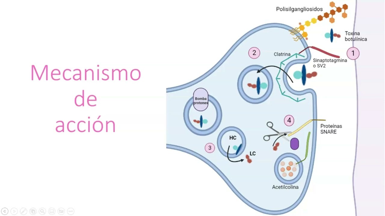 Toxina botulínica y tratamiento de distonías