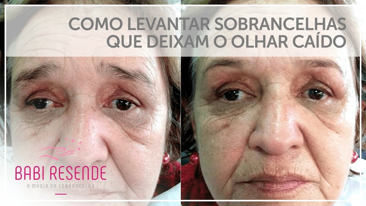 Curso design de sobrancelhas #10: Como levantar sobrancelhas caídas  que deixam o olhar triste