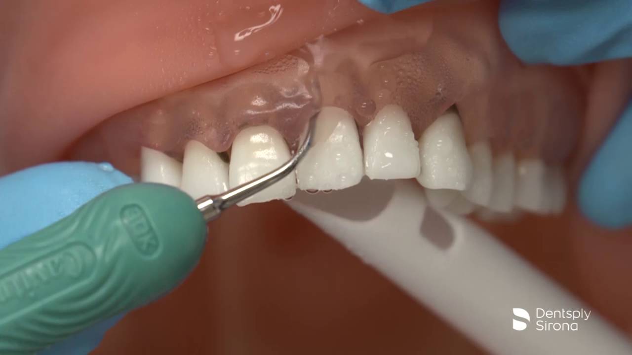 Cavitron&reg; Slimline&reg; 10 30K Ultrasonic Insert | Dentsply Sirona
