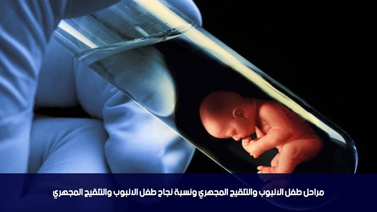 مراحل طفل الانبوب والتلقيح المجهري ونسبة نجاح طفل الانبوب والتلقيح المجهري