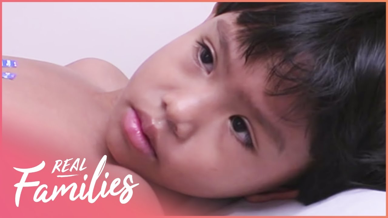 Real Families: Heart Surgery & Kidney Transplant | Little Miracles